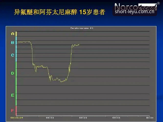乐鱼赛事即时赔付率监测安全吗 乐鱼赛事即时赔付率监测安全性深度分析